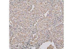 IHC analysis of COX IV using anti-COX IV antibody (ABIN7602090).