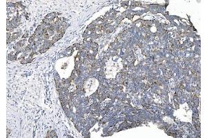 IHC analysis of CHCHD10 using anti-CHCHD10 antibody (ABIN7602507). (CHCHD10 anticorps  (AA 80-142))