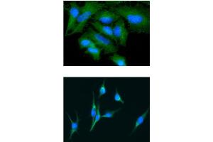 ICC/IF analysis of GAS7 in HeLa cells line, stained with DAPI (Blue) for nucleus staining and monoclonal anti-human GAS7 antibody (1:100) with goat anti-mouse IgG-Alexa fluor 488 conjugate (Green).