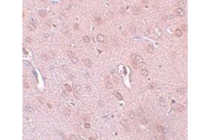 Immunohistochemical staining of rat brain tissue with KCNK18 polyclonal antibody  at 5 ug/mL dilution. (KCNK18 anticorps)
