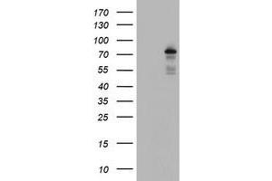 Western Blotting (WB) image for anti-BTB and CNC Homology 1, Basic Leucine Zipper Transcription Factor 1 (BACH1) antibody (ABIN1496803)