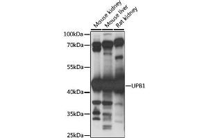 Western blot analysis of extracts of various cell lines, using UPB1 antibody.