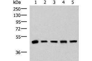 Western blot analysis of Human fetal liver tissue HepG2 A172 Hela and Jurkat cell lysates using PCYT2 Polyclonal Antibody at dilution of 1:800 (PCYT2 anticorps)