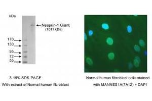 Image no. 1 for anti-Spectrin Repeat Containing, Nuclear Envelope 1 (SYNE1) antibody (ABIN1042627) (SYNE1 anticorps)