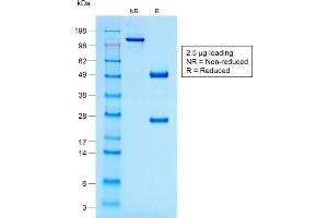 SDS-PAGE Analysis Purified ACTH Mouse Recombinant Monoclonal Antibody (r57). (Recombinant POMC anticorps  (N-Term))