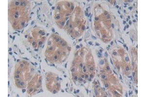 Detection of TLR5 in Human Stomach Tissue using Monoclonal Antibody to Toll Like Receptor 5 (TLR5)