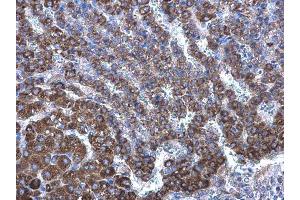 IHC-P Image Seladin 1 antibody [N1C2] detects Seladin 1 protein at cytoplasm on rat adrenal gland by immunohistochemical analysis.