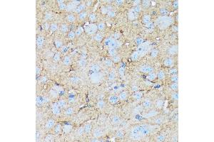 Immunohistochemistry of paraffin-embedded mouse brain using Versican Rabbit mAb (ABIN7271309) at dilution of 1:100 (40x lens).