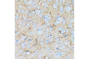 Immunohistochemistry of paraffin-embedded mouse brain using Versican Rabbit mAb (ABIN7271309) at dilution of 1:100 (40x lens). (Versican anticorps)