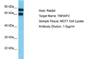 Host: Rabbit Target Name: TNFAIP2 Sample Tissue: Human MCF7 Whole Cell Antibody Dilution: 1ug/ml (TNFAIP2 anticorps  (N-Term))