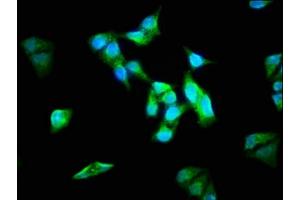Immunofluorescence staining of Hela cells with ABIN7143957 at 1:133, counter-stained with DAPI. (ALMS1 anticorps  (AA 889-1057))