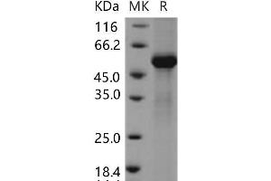 Western Blotting (WB) image for Tissue Factor Pathway Inhibitor 2 (TFPI2) protein (Fc Tag) (ABIN7198256)