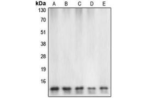 Western blot analysis of Caspase 7 expression in HeLa (A), mouse heart (B), rat heart (C), Jurkat etoposid-treated (D), HEK293T (E) whole cell lysates. (Caspase 7 anticorps  (Center))
