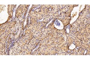 Detection of PIIINP in Human Kidney Tissue using Monoclonal Antibody to Procollagen III N-Terminal Propeptide (PIIINP) (PIIINP anticorps)