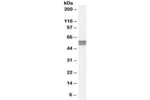 Western blot testing of human bone marrow lysate with CACNB4 antibody at 0. (CACNB4 anticorps)