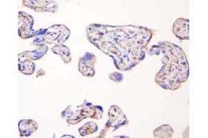 IHC analysis of TJP1 using anti-TJP1 antibody (ABIN7599787).