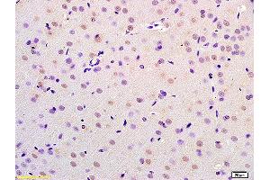 Formalin-fixed and paraffin embedded rat brain labeled with Anti-CHMP4B/CHMP4C Polyclonal Antibody, Unconjugated (ABIN872575) at 1:200 followed by conjugation to the secondary antibody and DAB staining. (CHMP4B anticorps  (AA 101-200))