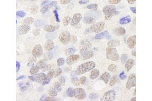 anti-Tripartite Motif Containing 24 (TRIM24) (AA 700-750) antibody