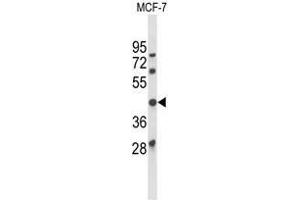 Western blot analysis of ATXN3 Antibody (Center) in MCF-7 cell line lysates (35µg/lane). (Ataxin 3 anticorps  (Middle Region))