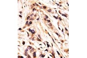 Image no. 2 for anti-Retinoblastoma 1 (RB1) (pSer608) antibody (ABIN358211) (Retinoblastoma 1 anticorps  (pSer608))