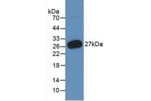 Detection of Recombinant PMP22, Human using Monoclonal Antibody to Peripheral Myelin Protein 22 (PMP22) (PMP22 anticorps  (AA 31-133))
