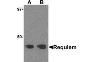 Western blot analysis of Requiem in mouse kidney tissue lysate with Requiem antibody at 1 μg/ml. (DPF2 anticorps  (C-Term))