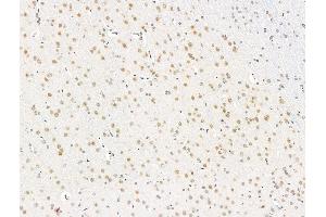 ABIN7094825 and ABIN7098876 at 1/100 staining Rat brain tissue by IHC-P. (RECQL5 anticorps  (C-Term))