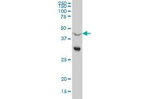 NR0B1 monoclonal antibody (M03), clone 1F10 Western Blot analysis of NR0B1 expression in Hela S3 NE .