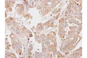 IHC-P Image Immunohistochemical analysis of paraffin-embedded OVCAR3 xenograft, using PCK2, antibody at 1:100 dilution.