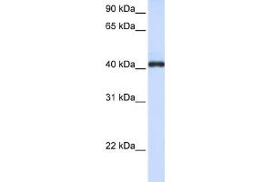 WB Suggested Anti-FCRLA Antibody Titration:  0. (FCRLA anticorps  (C-Term))