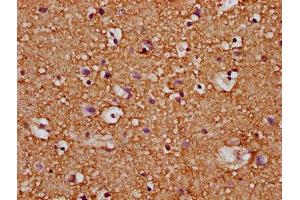 IHC image of ABIN7167153 diluted at 1:200 and staining in paraffin-embedded human brain tissue performed on a Leica BondTM system.
