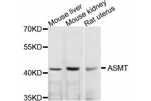 Western blot analysis of extracts of various cell lines, using ASMT antibody (ABIN5999240) at 1/1000 dilution. (ASMT anticorps)