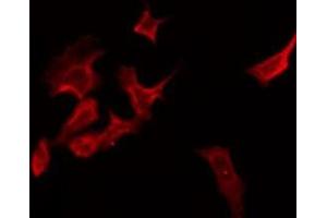 ABIN6275876 staining Hela by IF/ICC. (BTLA anticorps  (C-Term))