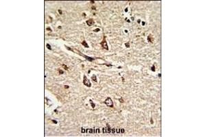 Formalin-fixed and paraffin-embedded human brain tissue reacted with PDIA6 Antibody (Center ), which was peroxidase-conjugated to the secondary antibody, followed by DAB staining.
