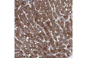Immunohistochemical staining of human liver with VPS37D polyclonal antibody  shows strong cytoplasmic positivity in hepatocytes. (VPS37D anticorps)