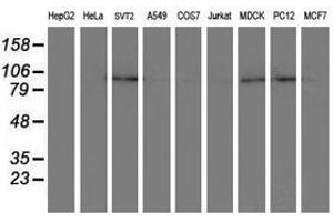 Image no. 3 for anti-Dipeptidyl-Peptidase 8 (DPP8) antibody (ABIN1497835) (DPP8 anticorps)