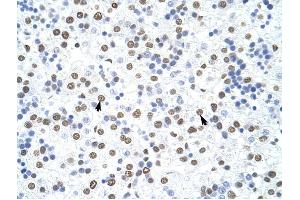 HNRPD antibody was used for immunohistochemistry at a concentration of 4-8 ug/ml to stain Hepatocytes (arrows) in Human Liver.