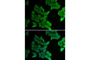 Immunofluorescence analysis of HeLa cells using GJA5 antibody. (Cx40/GJA5 anticorps)