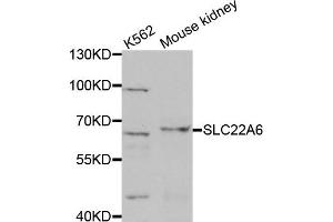 Western Blotting (WB) image for anti-Solute Carrier Family 22 Member 6 (SLC22A6) antibody (ABIN1876924)