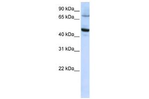 WB Suggested Anti-CYP46A1 Antibody Titration:  0.