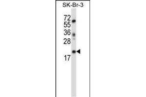 LIN52 Antibody (N-term ) (ABIN657405 and ABIN2846445) western blot analysis in SK-BR-3 cell line lysates (35 μg/lane). (LIN52 anticorps  (N-Term))