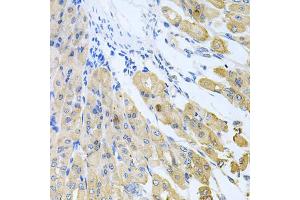 Immunohistochemistry of paraffin-embedded mouse stomach using CASP9 antibody (ABIN5997370) at dilution of 1/100 (40x lens). (Caspase 9 anticorps)
