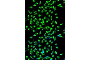 Immunofluorescence analysis of MCF-7 cell using CLDN7 antibody.