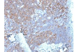 Formalin-fixed, paraffin-embedded human Tonsil stained with Laminin Receptor Monospecific Mouse Monoclonal Antibody (RPSA/2699).