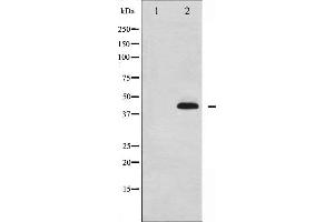 Western blot analysis of p38 MAPK phosphorylation expression in Jurkat whole cell lysates,The lane on the left is treated with the antigen-specific peptide.
