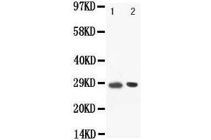 Anti-BOB1 antibody, Western blotting Lane: Rat Spleen Tissue Lysate
