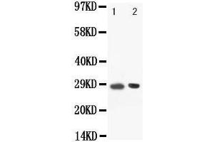 Anti-BOB1 antibody, Western blotting Lane: Rat Spleen Tissue Lysate (POU2AF1 anticorps  (C-Term))