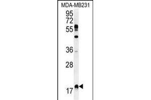 RHEB Antibody (C-term) (ABIN655712 and ABIN2845163) western blot analysis in MDA-M cell line lysates (35 μg/lane). (RHEB anticorps  (C-Term))