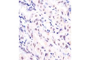 (ABIN6242774 and ABIN6577127) staining EX1 in human stomach sections by Immunohistochemistry (IHC-P - paraformaldehyde-fixed, paraffin-embedded sections). (APEX1 anticorps)