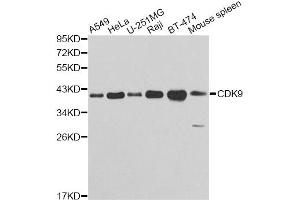 Western blot analysis of extracts of various cell lines, using CDK9 antibody (ABIN5970745) at 1/1000 dilution. (CDK9 anticorps)